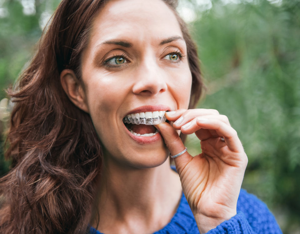 Neviditelná rovnátka Invisalign